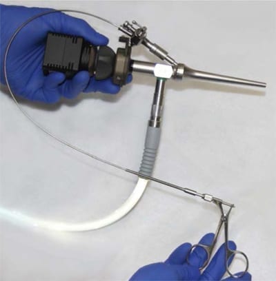 Video Otoscopy System